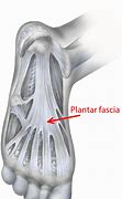 Image result for Plantar Fascia Ligament Pain