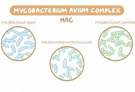 Image result for Mycobacterium Avium Infection