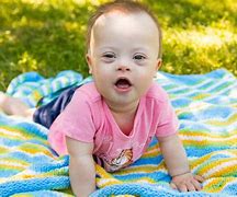 Image result for Down Syndrome Baby Pictures