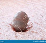 Image result for Mite Size