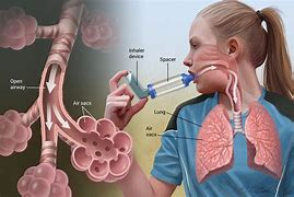 Image result for Band Called Asthma