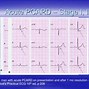 Image result for Pericarditis EKG Findings Example