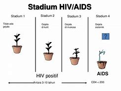 Image result for HIV Dan Aids