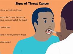 Image result for Vaping Lump in Throat