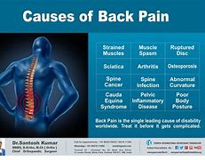 Image result for Back Pain Chart