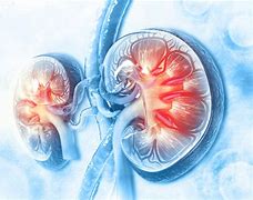 Image result for Chronic Kidney Disease