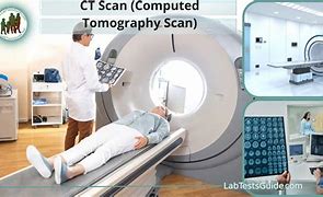 Image result for Capitate CT Scan