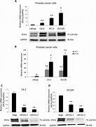 Image result for 4T1 MHC Expression