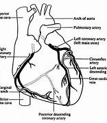 Image result for Atrioventricular Coronary Sulcus