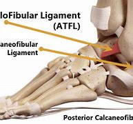 Image result for Lateral Malleolus Ligaments