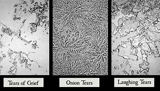 Image result for Happy vs Sad Tears Under a Microscope