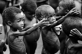 Image result for Starving Babies in Africa