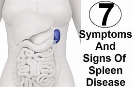 Image result for Spleen Disease Symptoms