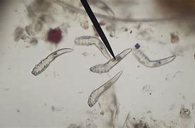 Image result for Demodex Infestation