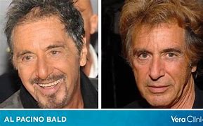 Image result for Al Pacino Bald