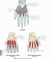 Image result for Ventral Aspect of Wrist