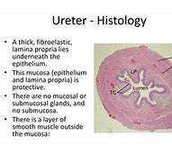 Image result for J-shaped Ureter