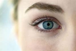 Image result for Cat Eye Syndrome