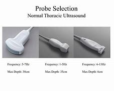 Image result for Lung Ultrasound Probe