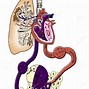 Image result for Emphysema Cartoon