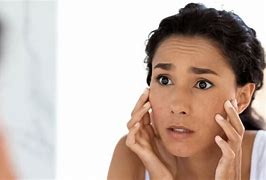 Image result for Skin Darkening