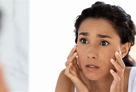 Image result for Skin Darkening On Face