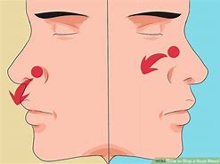 Image result for Aesthetic Nose Bleed