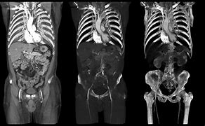 Image result for Full-Body CT Scan