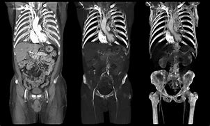 Image result for CT Scan Views