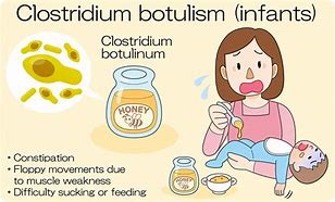 Image result for Botulism