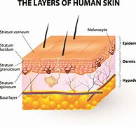 Image result for Dermis Skin Cut