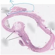 Image result for Ear Canal Diagram