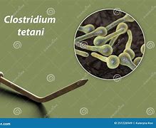 Image result for Rusty Nail Tetanus