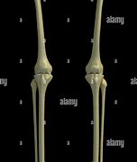 Image result for Knee Bones and Joints