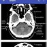 Image result for CT Scan Views