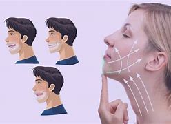 Image result for Pointy Chin Surgery