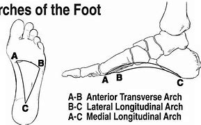 Image result for Three Arches of the Foot