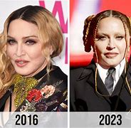 Image result for Madonna Today Plastic Surgery