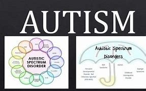 Image result for 12 Characteristics of Autism