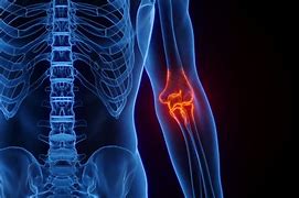 Image result for Outer Elbow Pain