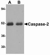 Image result for Caspase Antibody