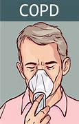 Image result for Best Treatment for COPD Illustration