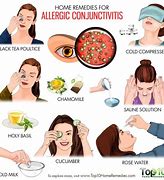 Image result for Allergic Conjunctivitis Treatment