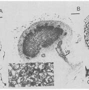 Image result for Soybean Nodule