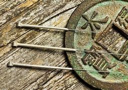 Image result for Acupuncture