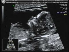 Image result for Male Baby Ultrasound