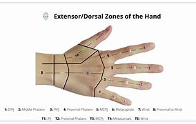 Image result for Volar and Dorsal Hand