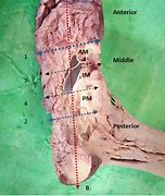 Image result for Plantar Artery