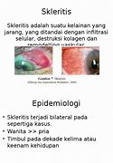 Image result for Skleritis