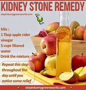 Image result for Kidney Stone Remedy